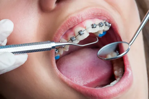 Unveiling The Work Structure Of orthodontics in Parramatta