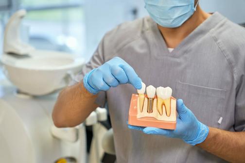 Restore Your Smile With Dental Implants Drummoyne
