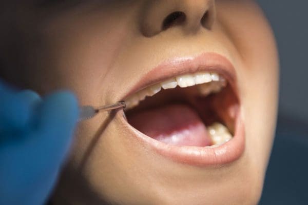 Discovering Your Ideal Dentist In Mill Park: A Community-Centric Approach