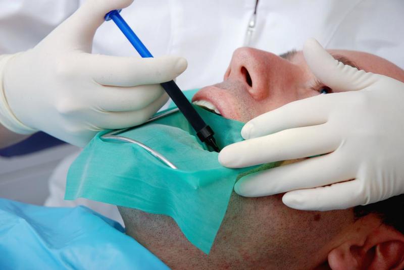 Root Canal Treatment Guildford – Advantages It Holds From Experienced Dentists